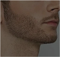 Facial hair