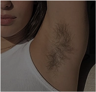 Underarm