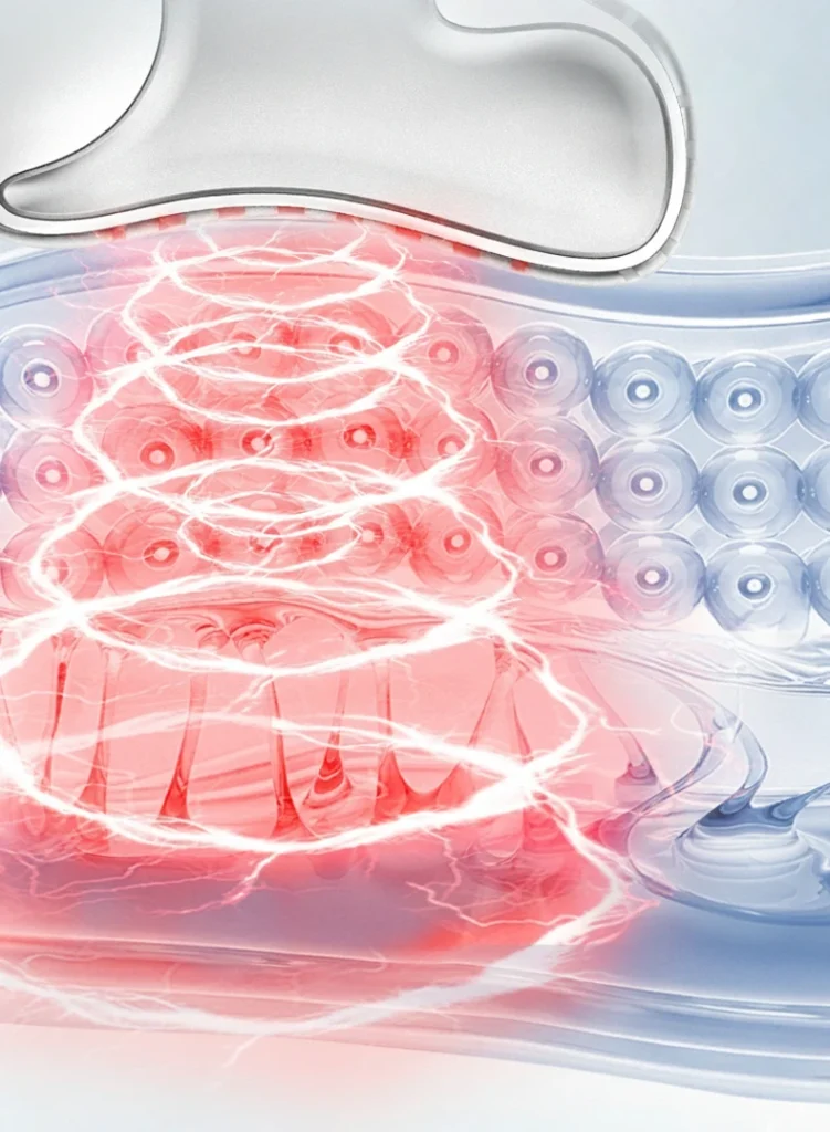 Vフェイスモード - マイクロカレント(MC)
